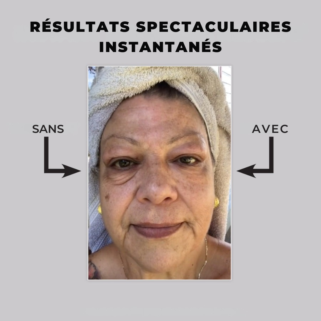 Eyelixir™ Lifting Contour des Yeux en 5 Minutes — Dites adieu aux poches et aux ridules