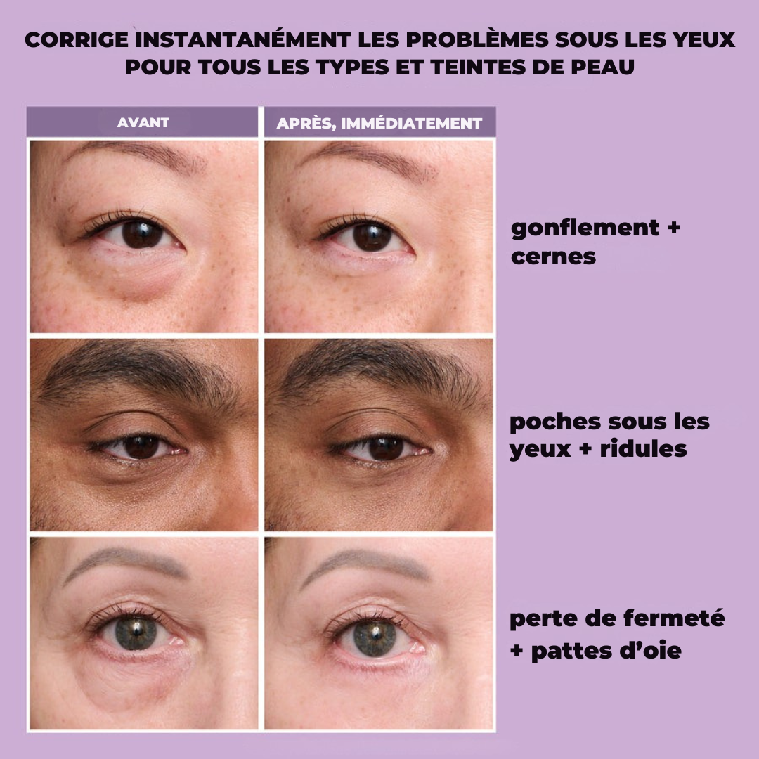 Eyelixir™ Lifting Contour des Yeux en 5 Minutes — Dites adieu aux poches et aux ridules