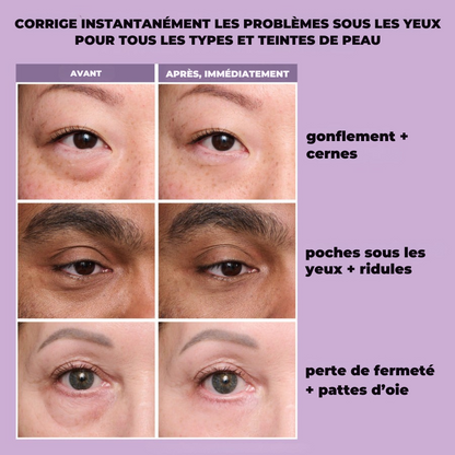 Eyelixir™ Lifting Contour des Yeux en 5 Minutes — Dites adieu aux poches et aux ridules